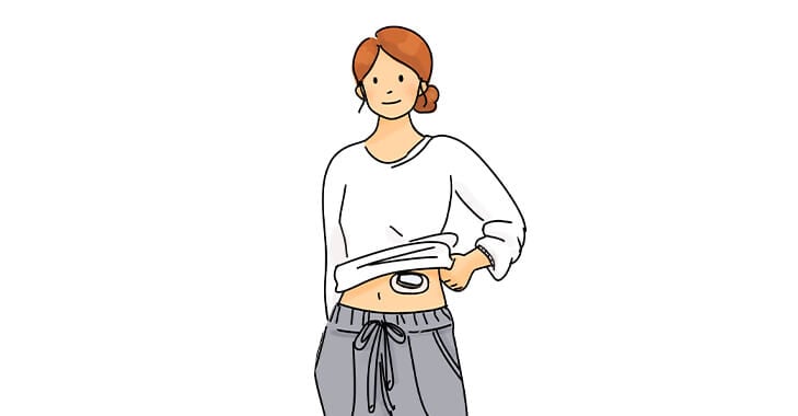 CGMってどんなもの？