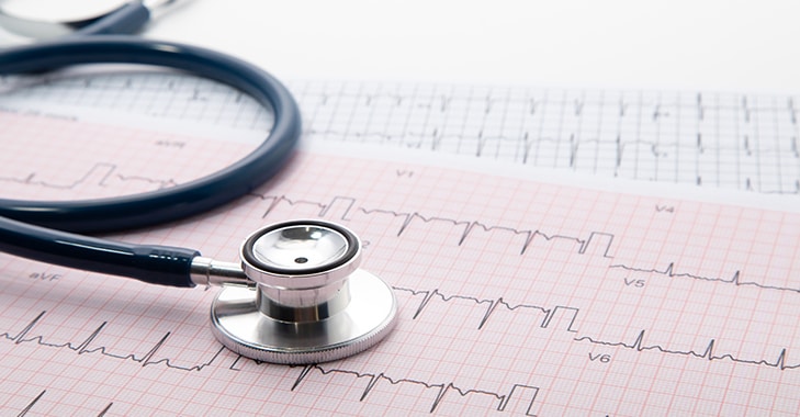 そのモニター心電図、Ⅱ誘導のままで良い？