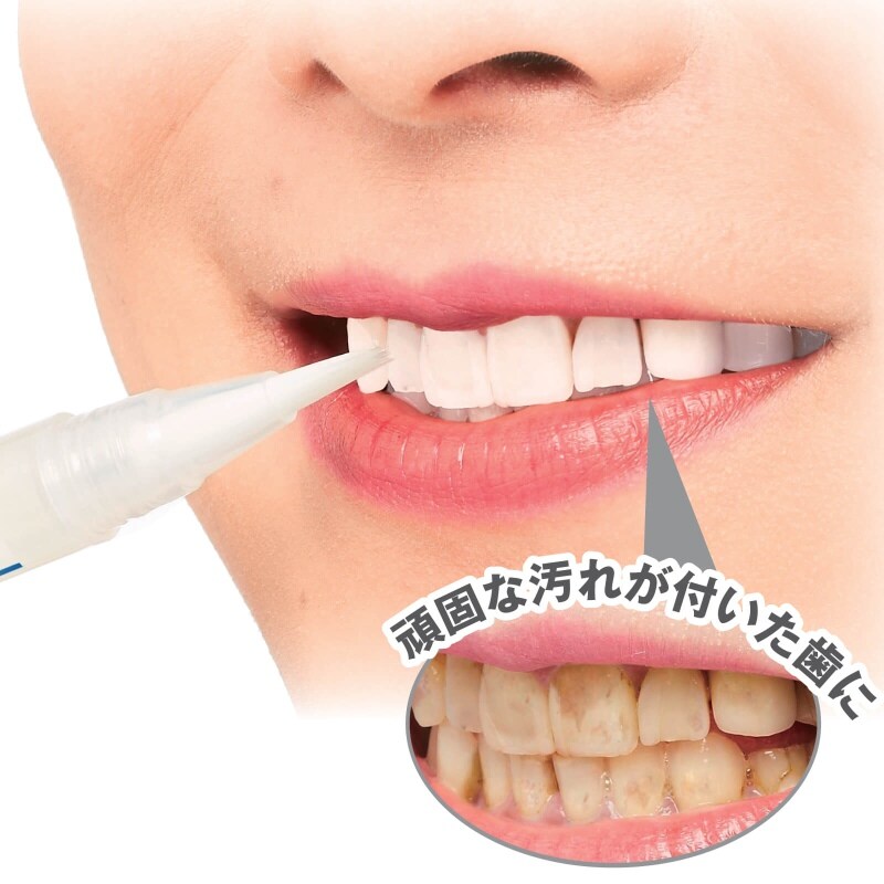 薬用重曹ステインプロホワイトニングレーザー ファッション雑貨 看護師 ナース の通販ならアンファミエ