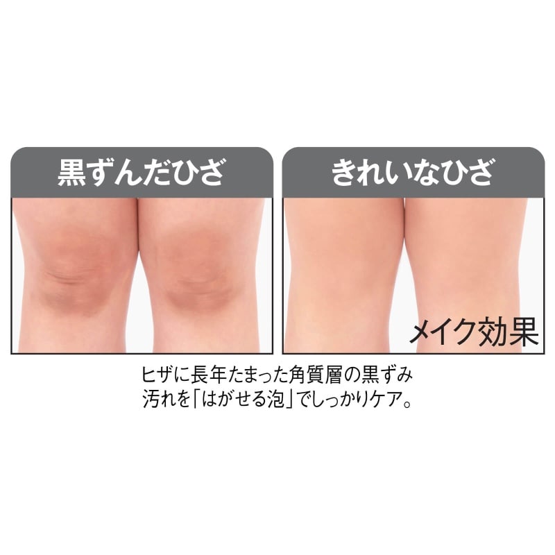ヒザアワーナバブルクリアパック ファッション雑貨 看護師 ナース の通販ならアンファミエ